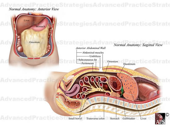 enterolysis1