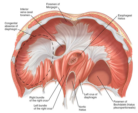 What happens during laparoscopic hernia repair?