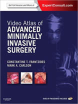 video-atlas-of-minimally-invasive-surgery-book